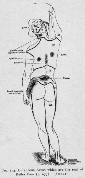 Dana's Areas - Back 