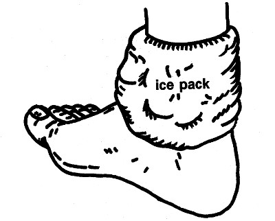 The Ice Pack
